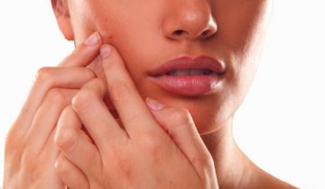 L’ acné hormonale, comment la vaincre?